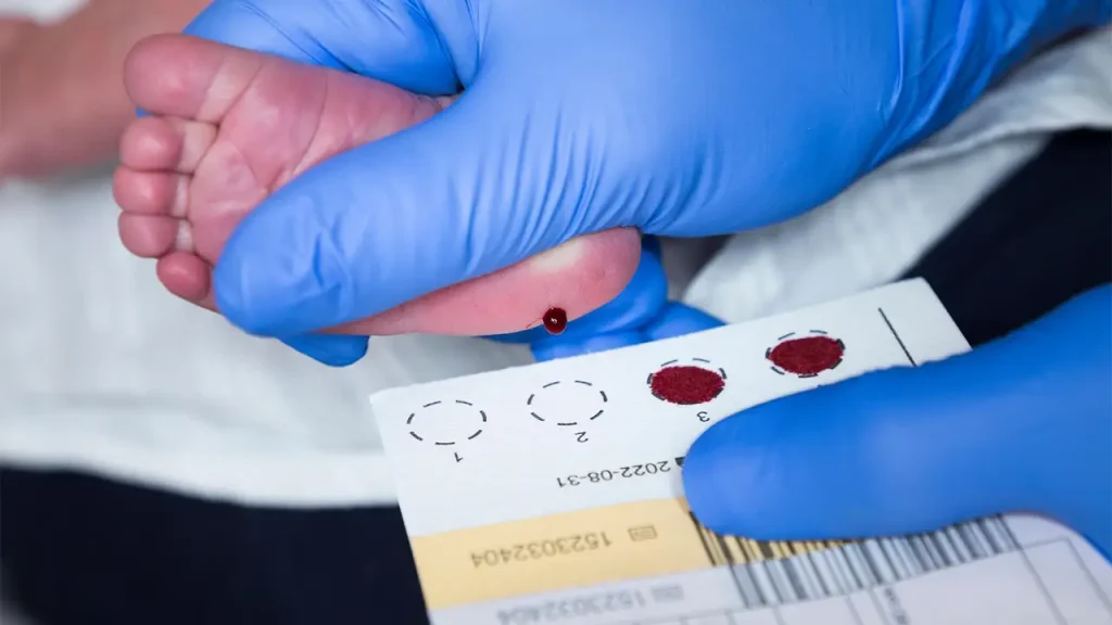 غربالگری نوزادان